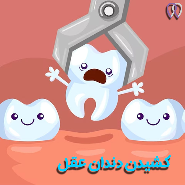 دندان عقل - دکتر روزبه روزبیانی