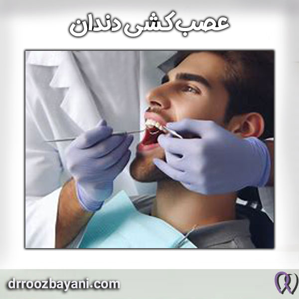 عصب کشی دندان دکتر روزبیانی در تهران