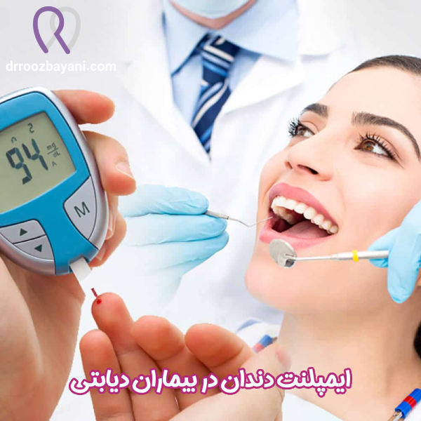 ایمپلنت دندان در بیماران دیابتی - دکترروزبه روز بیانی