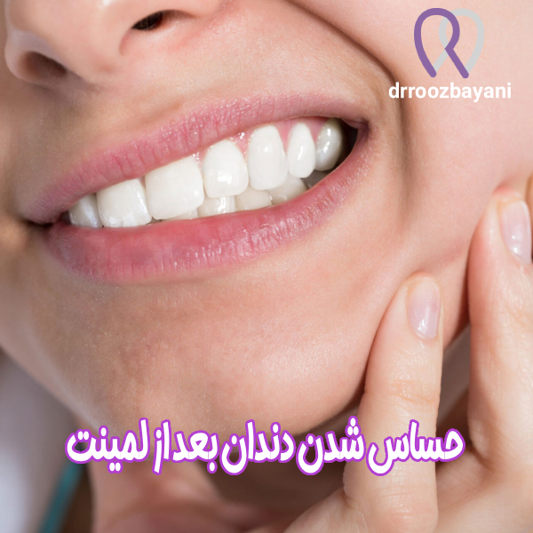 حساس شدن دندان بعد از لمینت - دکتر روزبه روز بیانی https://drroozbayani.com/