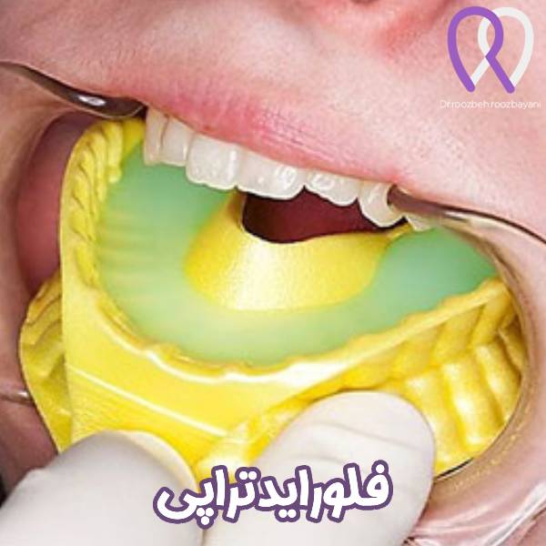 فلوراید تراپی