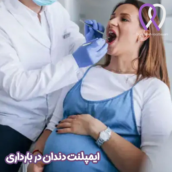 ایمپلنت دندان در بارداری