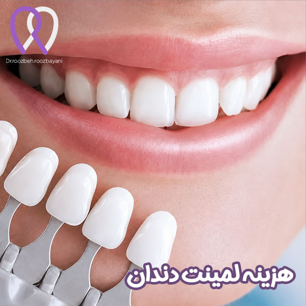 هزینه لمینت دندان | دکتر روزبه روزبیانی